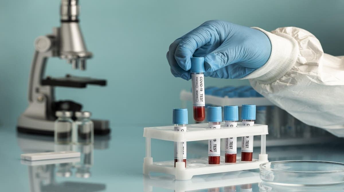 More Than Just Reports: The Evolving Experience of Getting Tested